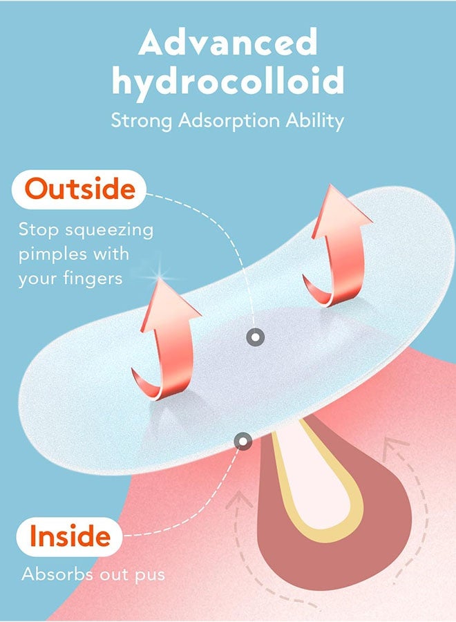 general Large Acne Pimple Patches, 5 Sizes 80 Patches for Large Breakouts, Acne Patches for Face, Chin or Body, Acne Spot Patch with Tea Tree & Calendula Oil, Hydrocolloid Bandages for Acne Skin - Image 5